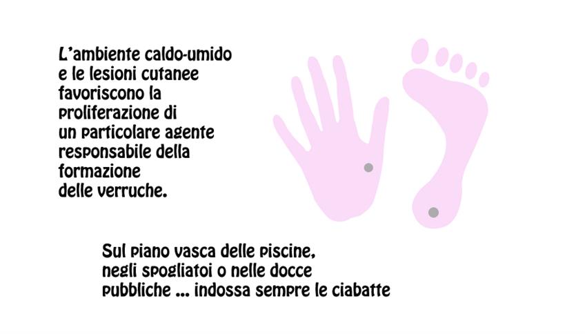 Le verruche? Davvero fastidiose Le verruche? Davvero fastidiose